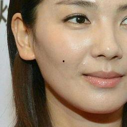 明星素颜痘痘,痘痘如何影响明星形象